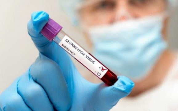 El Ministerio de Salud confirma 5 casos nuevos de viruela del símica