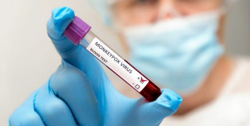 El Ministerio de Salud confirma 5 casos nuevos de viruela del símica