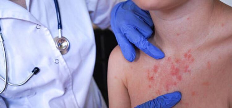 Salud confirma el fallecimiento de dos bebés por sarampión